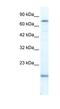 PiggyBac Transposable Element Derived 3 antibody, NBP1-57283, Novus Biologicals, Western Blot image 