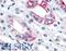 Estrogen Related Receptor Gamma antibody, LS-A5960, Lifespan Biosciences, Immunohistochemistry paraffin image 