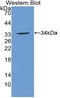 Actinin Alpha 3 (Gene/Pseudogene) antibody, LS-C314695, Lifespan Biosciences, Western Blot image 