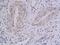 Integrin Subunit Beta 5 antibody, GTX03382, GeneTex, Immunohistochemistry paraffin image 