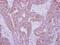 Interleukin 10 Receptor Subunit Alpha antibody, NBP2-16941, Novus Biologicals, Immunohistochemistry paraffin image 