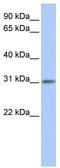 Outer Dense Fiber Of Sperm Tails 3 Like 1 antibody, TA337559, Origene, Western Blot image 