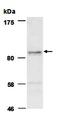 Helicase, Lymphoid Specific antibody, orb66739, Biorbyt, Western Blot image 