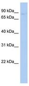 Procollagen-Lysine,2-Oxoglutarate 5-Dioxygenase 2 antibody, ab90088, Abcam, Western Blot image 