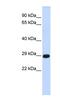 Chymotrypsinogen B1 antibody, NBP1-62678, Novus Biologicals, Western Blot image 