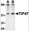 Perilipin 3 antibody, orb88272, Biorbyt, Western Blot image 