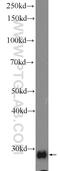 Glutathione S-Transferase Theta 2 (Gene/Pseudogene) antibody, 15063-1-AP, Proteintech Group, Western Blot image 