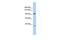 Adaptor Related Protein Complex 2 Subunit Beta 1 antibody, GTX45494, GeneTex, Western Blot image 