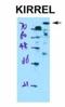 Kirre Like Nephrin Family Adhesion Molecule 1 antibody, NBP1-91309, Novus Biologicals, Western Blot image 