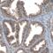 TBC1 Domain Family Member 23 antibody, PA5-58274, Invitrogen Antibodies, Immunohistochemistry paraffin image 