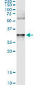 Annexin A3 antibody, LS-C139222, Lifespan Biosciences, Immunoprecipitation image 