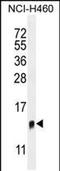 Transmembrane protein 100 antibody, PA5-48260, Invitrogen Antibodies, Western Blot image 