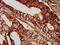 Succinate-CoA Ligase GDP-Forming Beta Subunit antibody, LS-C673425, Lifespan Biosciences, Immunohistochemistry paraffin image 