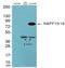 NBPF Member 12 antibody, abx014653, Abbexa, Western Blot image 