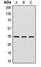 Cathepsin V antibody, LS-B16888, Lifespan Biosciences, Western Blot image 