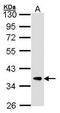 F-Box And Leucine Rich Repeat Protein 12 antibody, GTX104870, GeneTex, Western Blot image 