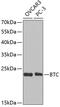 Betacellulin antibody, GTX30096, GeneTex, Western Blot image 