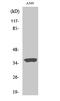 STEAP Family Member 1 antibody, STJ95822, St John