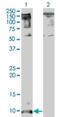 C-X-C motif chemokine 5 antibody, H00006374-M05, Novus Biologicals, Western Blot image 