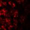 Transmembrane Protein 106B antibody, A03541, Boster Biological Technology, Immunofluorescence image 