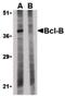 BCL2 Like 10 antibody, PA5-20234, Invitrogen Antibodies, Western Blot image 