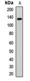 Tau Tubulin Kinase 2 antibody, LS-C668652, Lifespan Biosciences, Western Blot image 