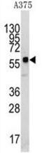 Kringle Containing Transmembrane Protein 1 antibody, GTX81373, GeneTex, Western Blot image 