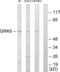 G Protein-Coupled Receptor Kinase 6 antibody, abx013489, Abbexa, Western Blot image 