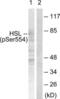 Lipase E, Hormone Sensitive Type antibody, LS-C199085, Lifespan Biosciences, Western Blot image 