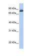 Gamma-Glutamyltransferase 7 antibody, orb325446, Biorbyt, Western Blot image 