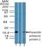 Presenilin Enhancer, Gamma-Secretase Subunit antibody, NBP2-24611, Novus Biologicals, Western Blot image 