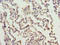 ERCC Excision Repair 6 Like 2 antibody, A62190-100, Epigentek, Immunohistochemistry paraffin image 