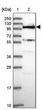SIK Family Kinase 3 antibody, PA5-60959, Invitrogen Antibodies, Western Blot image 