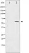 Mitogen-Activated Protein Kinase Kinase Kinase 8 antibody, abx012224, Abbexa, Western Blot image 