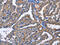 Protein kinase C delta type antibody, CSB-PA282230, Cusabio, Immunohistochemistry paraffin image 