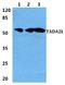 Transcriptional Adaptor 2A antibody, A08832-1, Boster Biological Technology, Western Blot image 