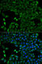 Solute Carrier Family 25 Member 13 antibody, LS-C747653, Lifespan Biosciences, Immunofluorescence image 