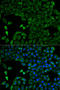 Citrin antibody, LS-C747653, Lifespan Biosciences, Immunofluorescence image 