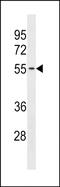 Thioredoxin Related Transmembrane Protein 3 antibody, PA5-49227, Invitrogen Antibodies, Western Blot image 