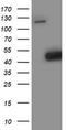 Spermine Synthase antibody, TA503096, Origene, Western Blot image 
