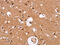 High Density Lipoprotein Binding Protein antibody, CSB-PA211136, Cusabio, Immunohistochemistry paraffin image 