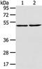 TBC1 Domain Family Member 22A antibody, TA350482, Origene, Western Blot image 