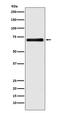 Solute Carrier Family 1 Member 2 antibody, M01713, Boster Biological Technology, Western Blot image 