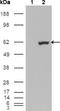 ETS Variant 1 antibody, NBP1-28868, Novus Biologicals, Western Blot image 