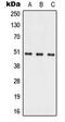 Alkaline Ceramidase 1 antibody, LS-C353859, Lifespan Biosciences, Western Blot image 