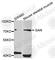 Gigaxonin antibody, A4205, ABclonal Technology, Western Blot image 