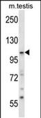 Sorting Nexin 14 antibody, PA5-48638, Invitrogen Antibodies, Western Blot image 