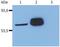 LCK Proto-Oncogene, Src Family Tyrosine Kinase antibody, GTX28075, GeneTex, Western Blot image 