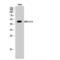 Mitogen-Activated Protein Kinase 8 antibody, LS-C384222, Lifespan Biosciences, Western Blot image 