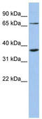 Zinc Finger Protein 274 antibody, TA345496, Origene, Western Blot image 